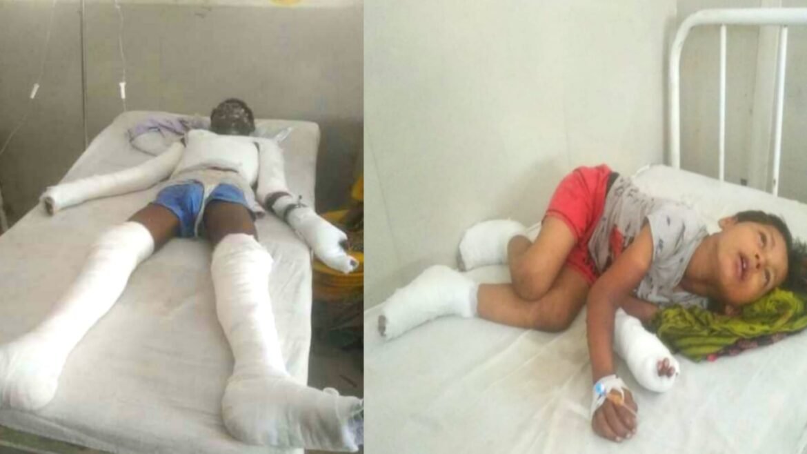 Fire in green gas line in Dayalbagh disrupted supply to 20,000 homes, clash between Airtel-Green Gas officials