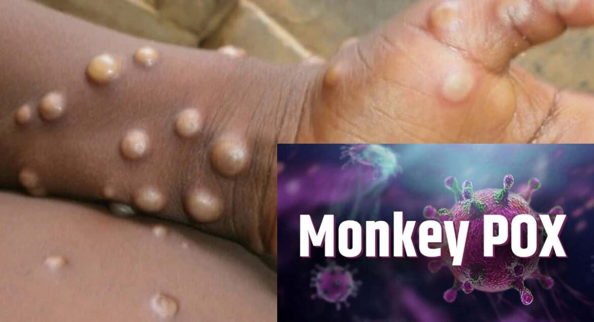 Alert about monkey pox after corona in Agra, keeping an eye on these tourists